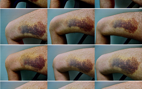 «Healing Process» (en cours) sur maintenant, synapse de Rachel Defay-Liautard. 